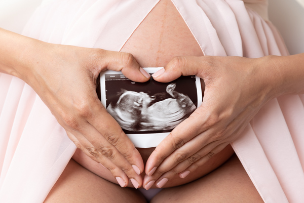 maternity photoshoot holding scan photo